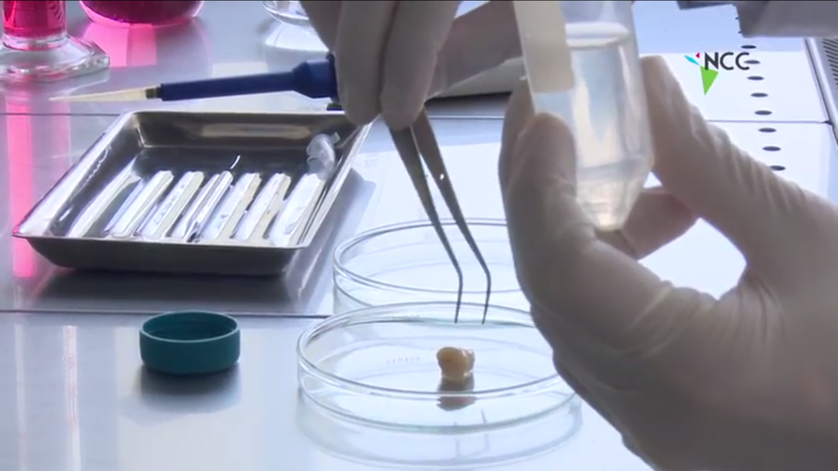 En Perú se investiga sobre la posibilidad de extraer células madre de piezas dentales