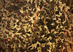 national-institute-of-allergy-and-infectious-diseases-IC5S8EKtad0-unsplash