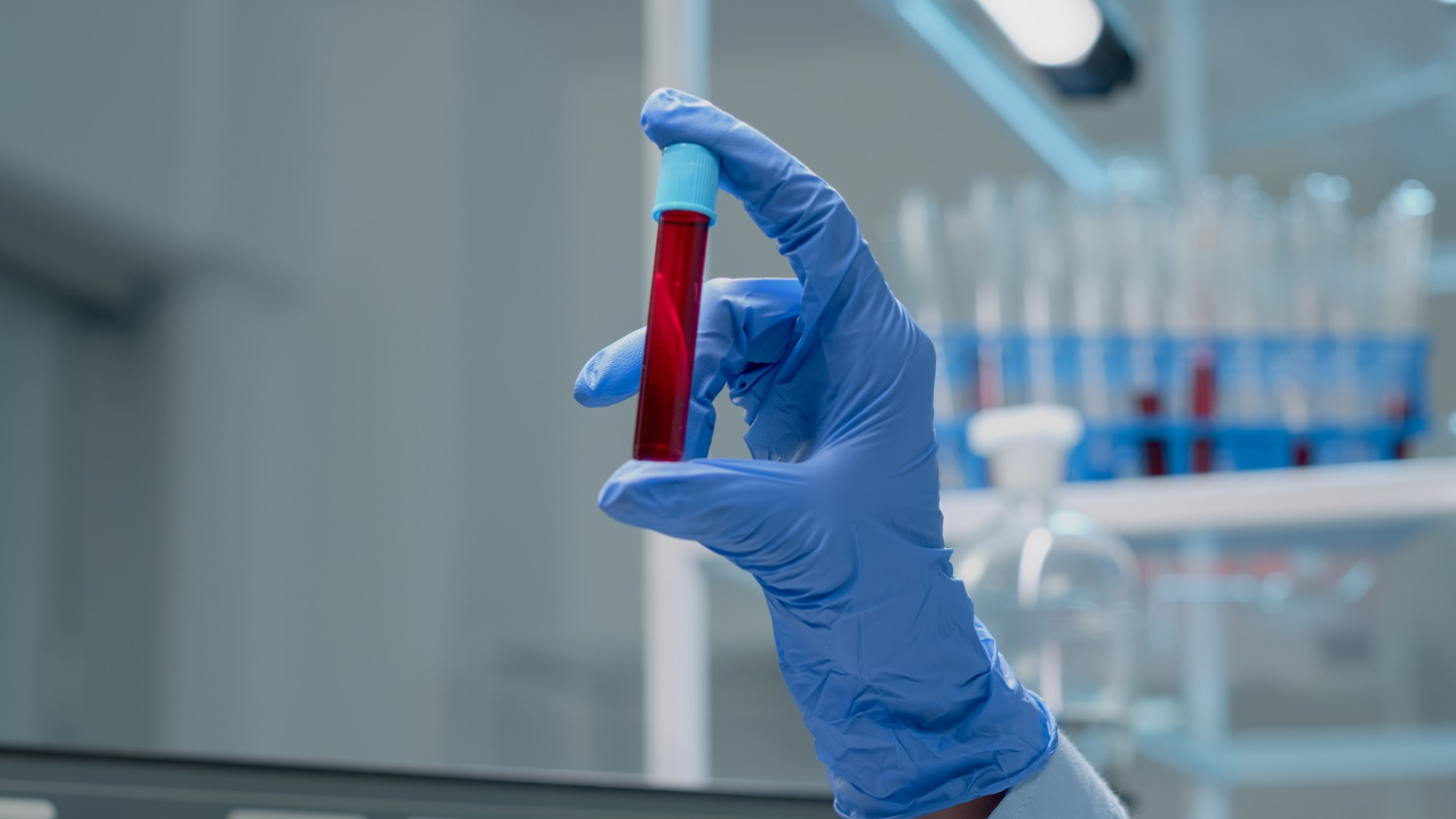 ¿Por qué es importante saber tu tipo de sangre?