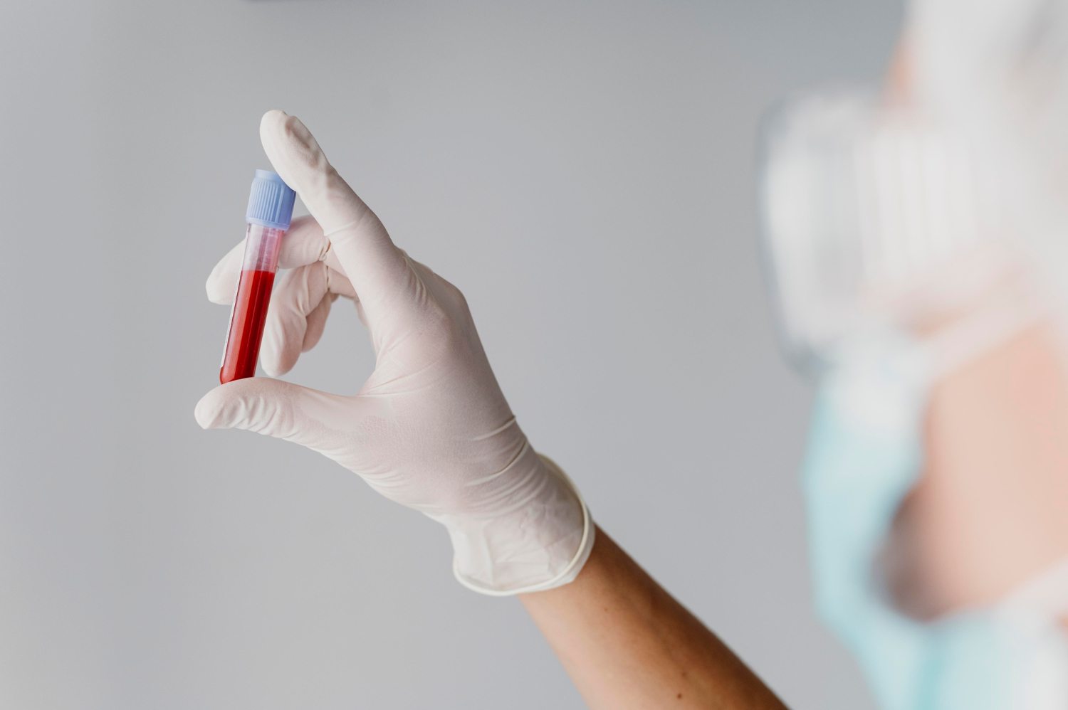 Un biomarcador en sangre busca diagnosticar el alzheimer