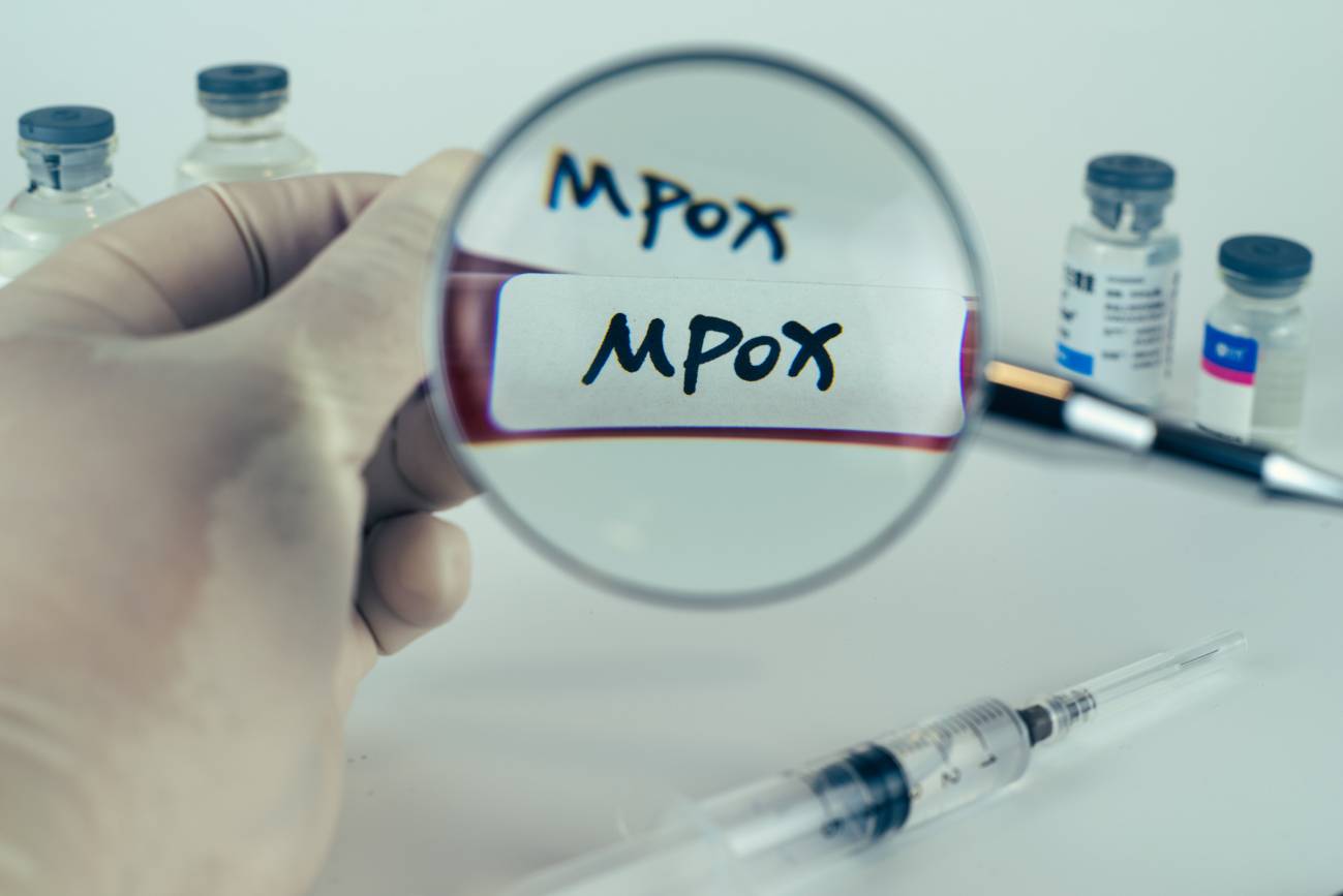 Cuatro de cada diez memes sobre mpox estigmatizan o promueven desinformación