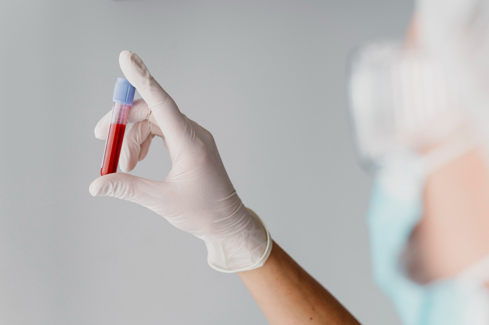 Análisis de sangre podría reemplazar muestras en médula ósea para detectar leucemia