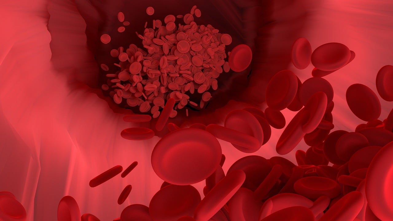 ¿Cuáles son los signos y síntomas de la anemia?