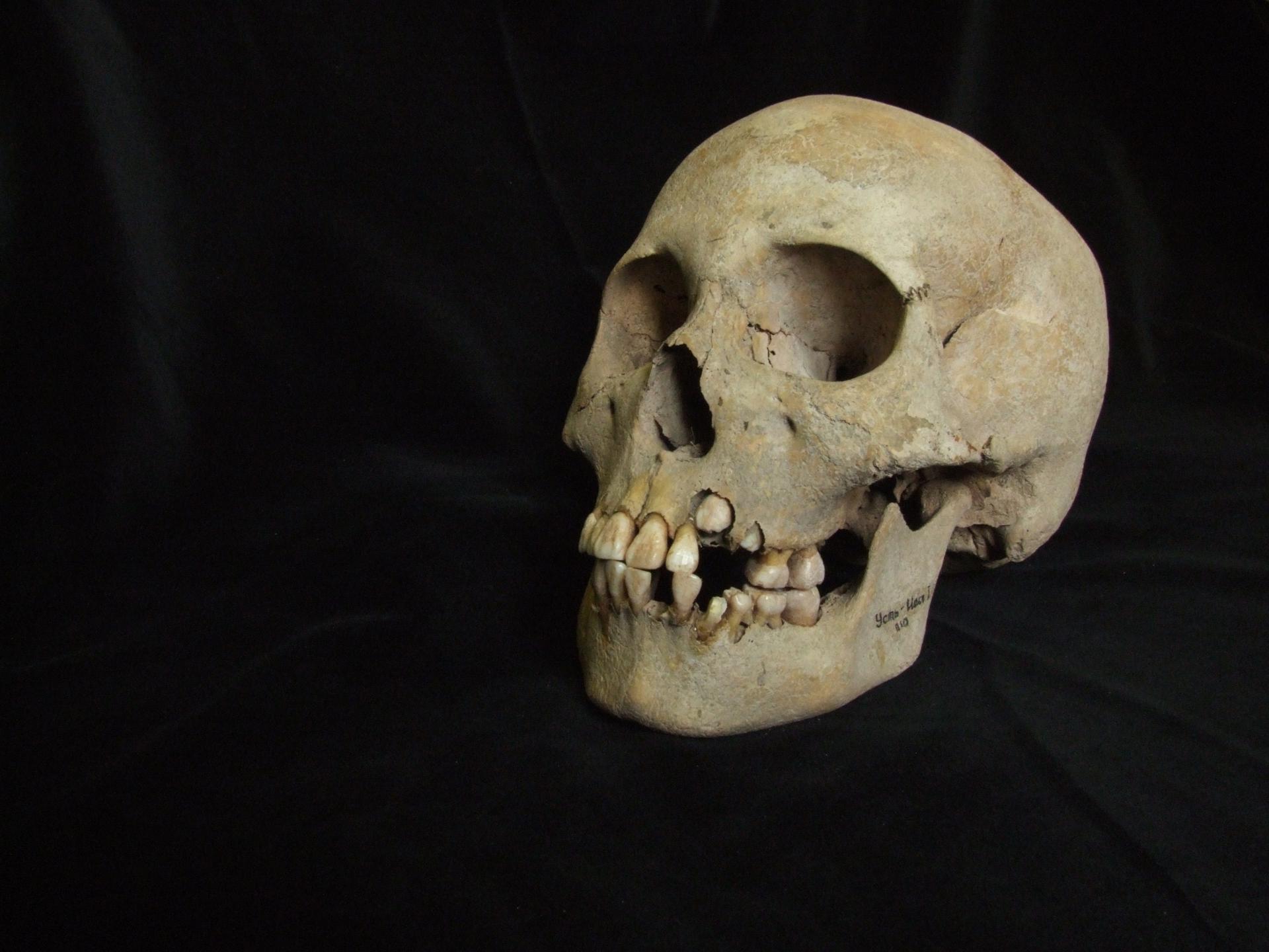 La cepa más antigua de la peste era muy letal y provocó brotes mortales hace 5.500 años
