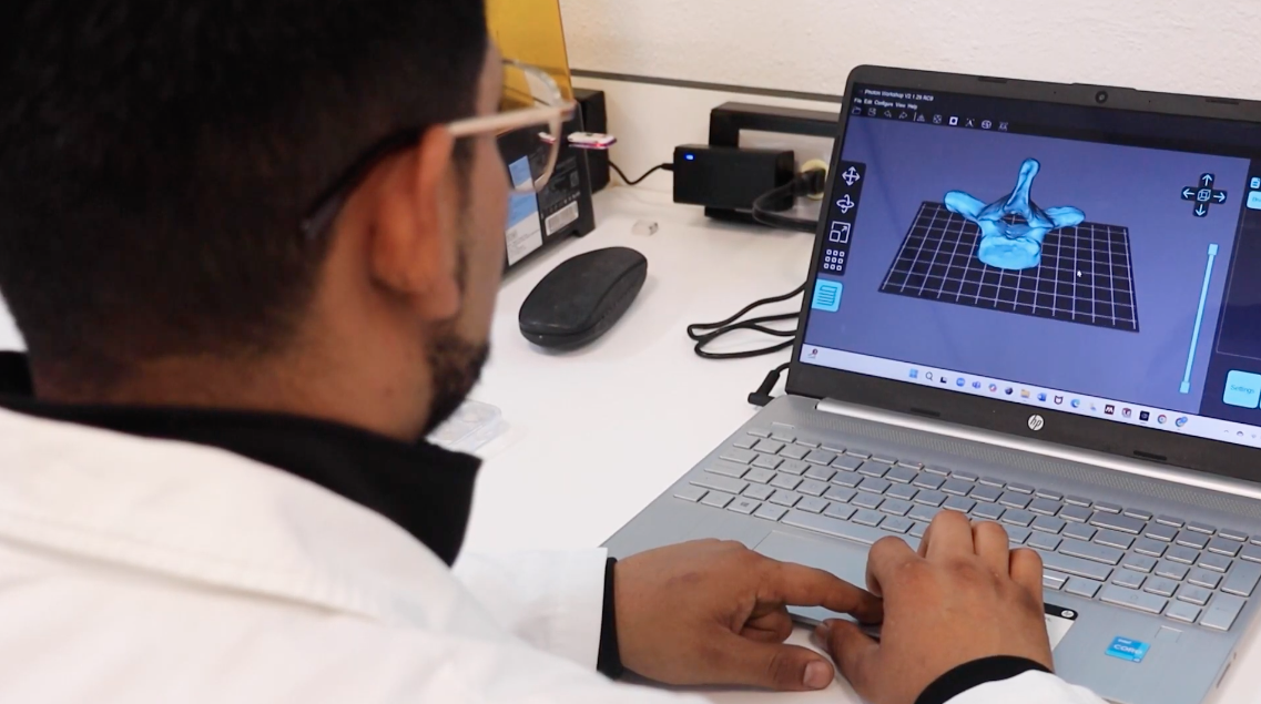 UAEH desarrolla biomaterial que ayuda a la regeneración ósea