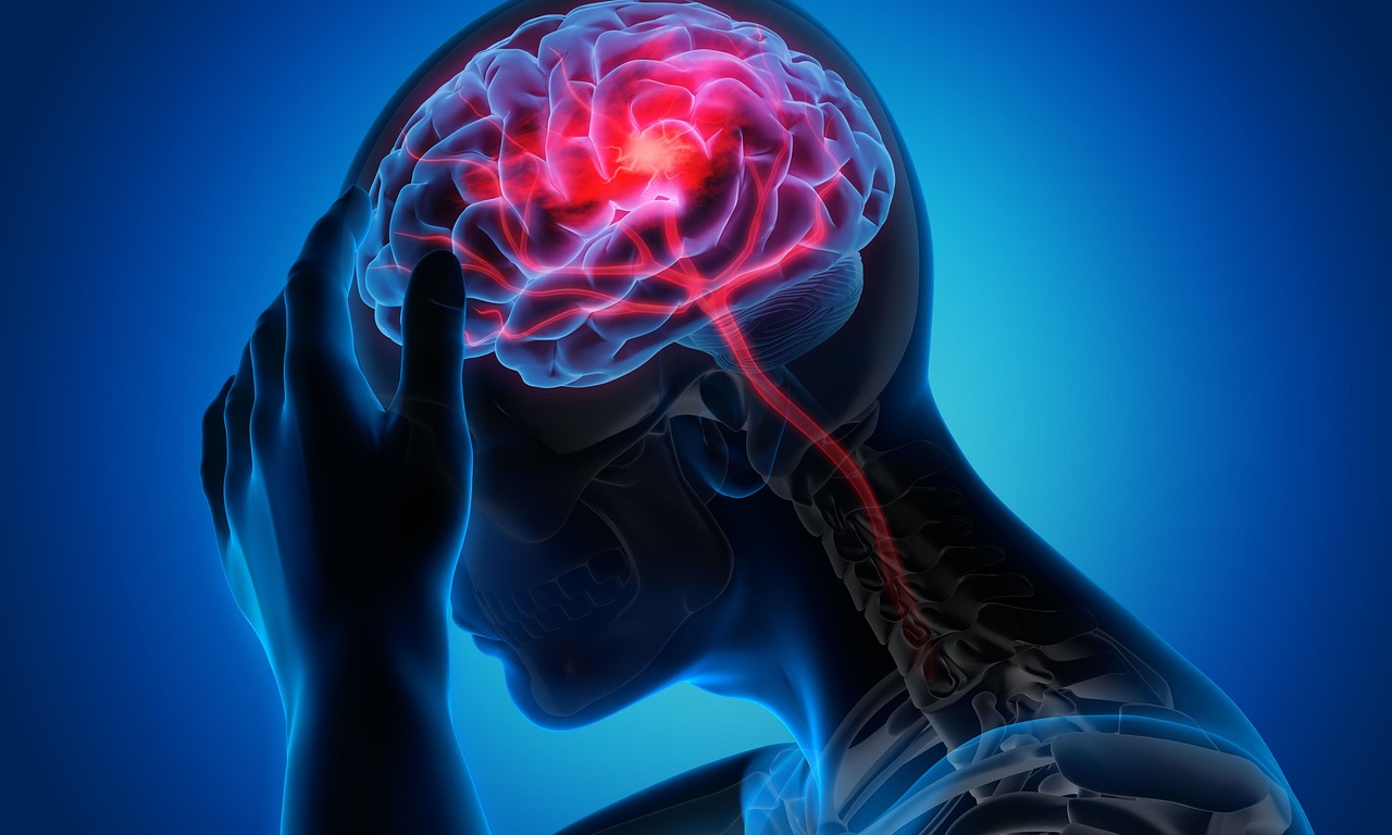 La migraña afecta a millones de personas de forma regular