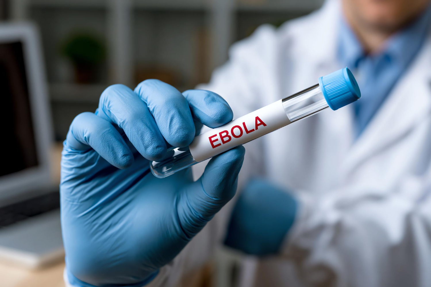 Evalúan tratamiento contra el ébola en personas expuestas